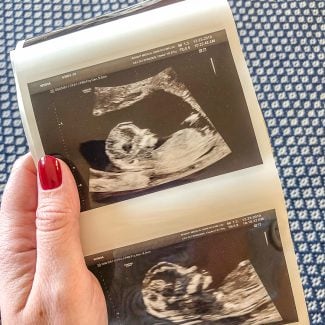 17 Things That Surprised Me About Pregnancy